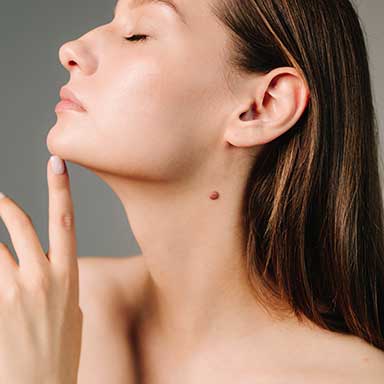 Contouring par injection d’acide hyaluronique